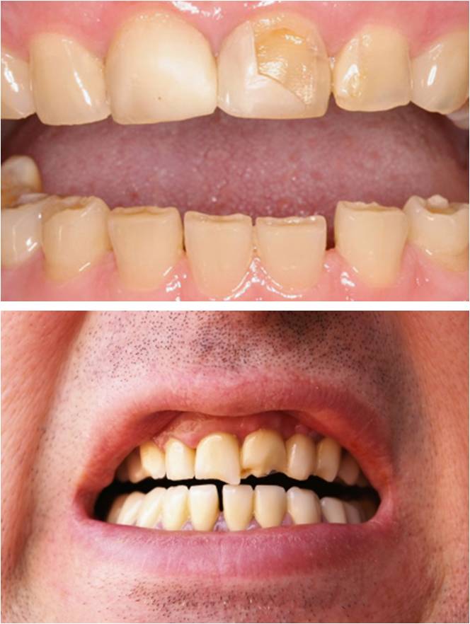 TMJ & Bruxism Dentist Tampa Florida FL - Dr Marnie Bauer is a general dentist specializing in TMJ, Bruxism / teeth grinding, teeth clenching & night guards in Tampa / South Tampa and the surrounding area. - Tampa FL TMJ Specialists