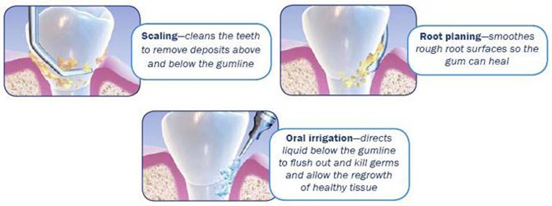 Tampa Dental Cleanings South Tampa FL | Dentist South Tampa | 813.839.2273 | Teeth Cleanings Tampa Florida - Dr Marnie Bauer is a general dentist and does dental cleanings, teeth cleanings & periodontal disease prevention in Tampa / South Tampa and the surrounding area. - Dental Cleanings Tampa